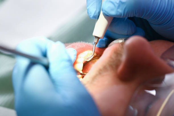 Best Pediatric Emergency Dentist in Wilson Conococheague, MD